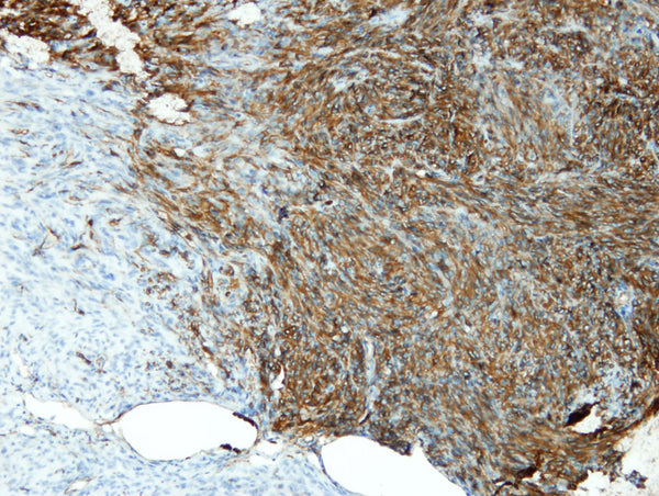 Anti-CD34 – Figure 1 of 2