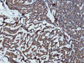 Anti-Synaptophysin – Figure 1 of 4