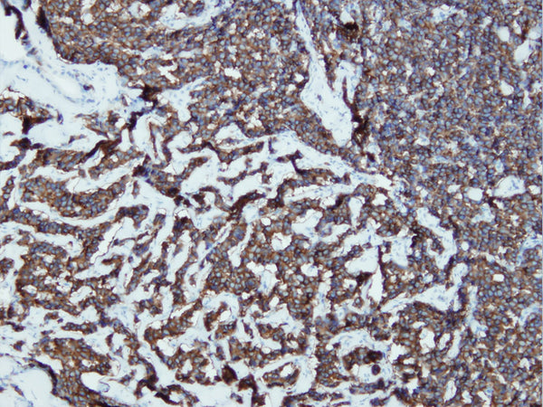 Anti-Synaptophysin – Figure 1 of 4