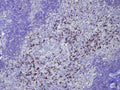 Anti-Human IgG – Figure 1 of 2