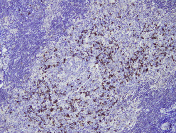 Anti-Human IgG – Figure 1 of 2