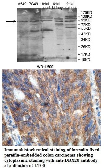 Anti-DDX20 Antibody – Figure 1 of 1