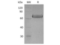 Recombinant Human EphA2 Protein (His Tag) – Figure 1 of 2