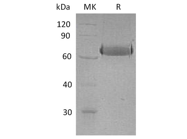 Recombinant Human EphA2 Protein (His Tag) – Figure 1 of 2