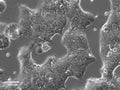 Detroit-562 cell