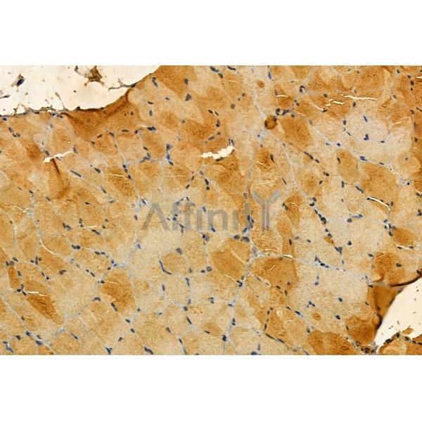 DF12058 at 1/100 staining Rat muscle tissue by IHC-P. The sample was formaldehyde fixed and a heat mediated antigen retrieval step in citrate buffer was performed. The sample was then blocked and incubated with the primary antibody at 4°C overnight. An HRP conjugated anti-Rabbit antibody was used as the secondary antibody.