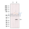 Mast Cell Chymase Antibody – Figure 1 of 4
