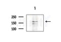 TITIN Antibody - Western blot analysis of extracts from EC304 cells, using TITIN Antibody at 1/1000 dilution.