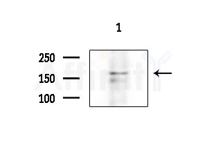TITIN Antibody - Western blot analysis of extracts from EC304 cells, using TITIN Antibody at 1/1000 dilution.