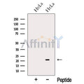 NUDT16 Antibody – Figure 1 of 1