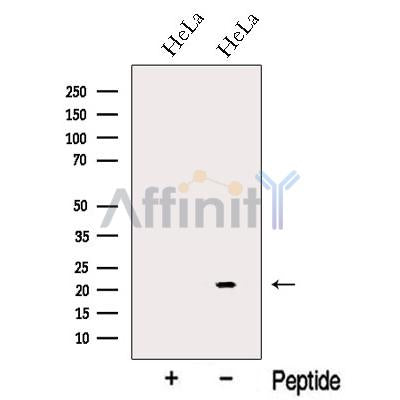 NUDT16 Antibody – Figure 1 of 1