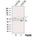 NUDT9 Antibody – Figure 1 of 2