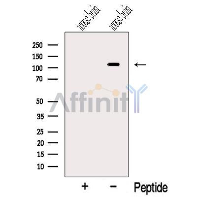 OGDHL Antibody – Figure 1 of 11