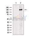 Neurofilament heavy polypeptide Antibody – Figure 1 of 5