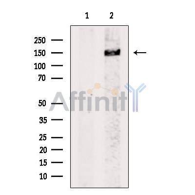 Neurofilament heavy polypeptide Antibody – Figure 1 of 5