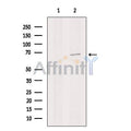 Collagen X Antibody – Figure 1 of 14