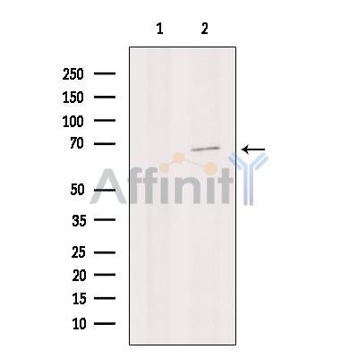 Collagen X Antibody – Figure 1 of 14