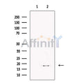Lymphocyte Antigen 6 Complex Antibody – Figure 1 of 2