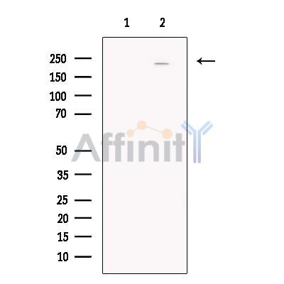 Nav1.5 Antibody – Figure 1 of 4