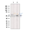 Carbonic Anhydrase IX Antibody – Figure 1 of 4