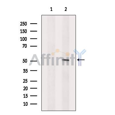 Carbonic Anhydrase IX Antibody – Figure 1 of 4