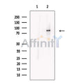 DLL4 Antibody – Figure 1 of 7