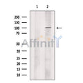 p90 Autoantigen Antibody – Figure 1 of 1
