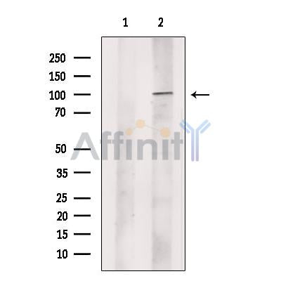 p90 Autoantigen Antibody – Figure 1 of 1