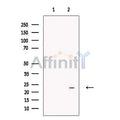 HAND2 Antibody – Figure 1 of 3