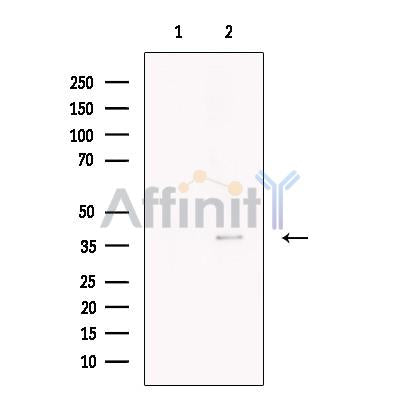 Necdin Antibody – Figure 1 of 1