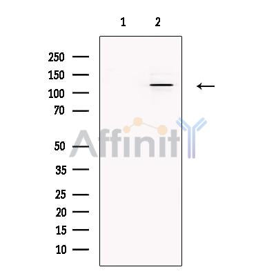 SMARCA1 Antibody – Figure 1 of 9