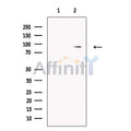 Guanylyl Cyclase alpha 2 Antibody – Figure 1 of 6