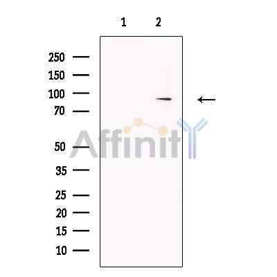 Guanylyl Cyclase alpha 2 Antibody – Figure 1 of 6