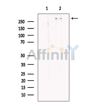 KMT2A / MLL Antibody – Figure 1 of 6