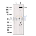 DNA Polymerase theta Antibody – Figure 1 of 18