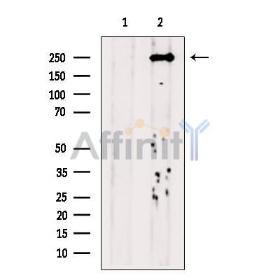 DNA Polymerase theta Antibody – Figure 1 of 18