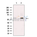 KMT5C/SUV4-20h2 Antibody – Figure 1 of 3