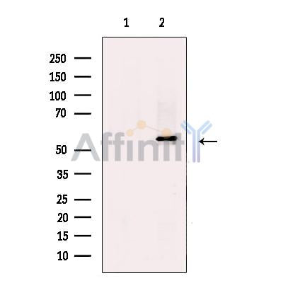 KMT5C/SUV4-20h2 Antibody – Figure 1 of 3
