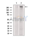 TRRAP Antibody – Figure 1 of 1