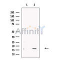 Gastrin Releasing Peptide Antibody – Figure 1 of 4