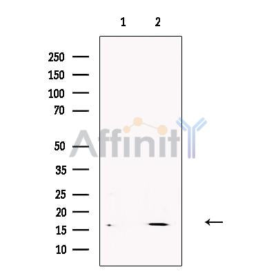 Gastrin Releasing Peptide Antibody – Figure 1 of 4