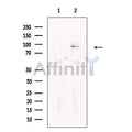 Glycogen synthase 2 Antibody – Figure 1 of 1