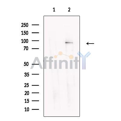 Glycogen synthase 2 Antibody – Figure 1 of 1