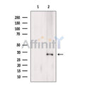 CD64 Antibody – Figure 1 of 2