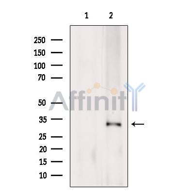 CD64 Antibody – Figure 1 of 2