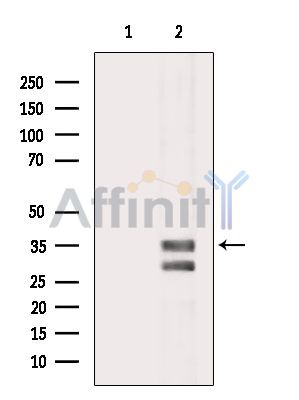 GSDMD N-Terminal Antibody(Mouse specific) – Figure 1 of 4