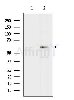 Western blot analysis of lysates from HepG2 cells(heat-shock treatment), using PYROXD1 Antibody. The lane on the left was treated with blocking peptide.