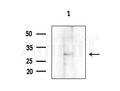 ELOVL1 Antibody - Western blot analysis of extracts from RAW264.