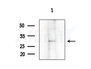 ELOVL1 Antibody - Western blot analysis of extracts from RAW264.