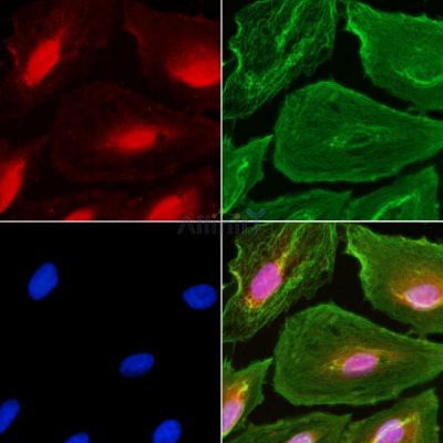 GCF Antibody - Figure 1 of 3